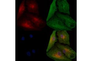 ABIN6266008 and ABIN6278040 staining  cells by IF/ICC. (WARS Antikörper  (Internal Region))