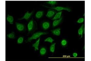Immunofluorescence (IF) image for anti-Metalloproteinase Inhibitor 2 (TIMP2) antibody (ABIN781825) (TIMP2 Antikörper)