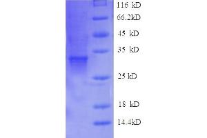 SDS-PAGE (SDS) image for Chymotrypsin-Like Elastase Family Member 2a (CEL2A) (AA 31-271) protein (His tag) (ABIN5709275) (CEL2A Protein (AA 31-271) (His tag))