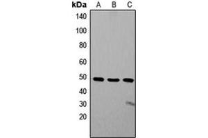 Western blot analysis of ZIC1/2/3 expression in SW480 (A), Jurkat (B), SHSY5Y (C) whole cell lysates. (ZIC1/2/3 Antikörper  (Center))