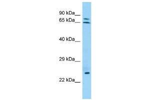 WB Suggested Anti-KRT74 Antibody Titration: 1. (KRT74 Antikörper  (N-Term))