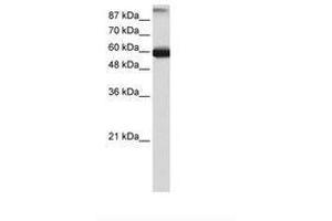 Image no. 2 for anti-General Transcription Factor IIIC, Polypeptide 5 (GTF3C5) (AA 148-197) antibody (ABIN6736178) (GTF3C5 Antikörper  (AA 148-197))