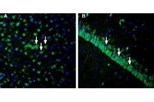 Expression of IGF1R in rat cortex and hippocampusImmunohistochemical staining of perfusion-fixed frozen rat brain sections with Anti-IGF1R (extracellular) Antibody (ABIN7043290, ABIN7044798 and ABIN7044799), (1:1200), followed by goat anti-rabbit-AlexaFluor-488. (Insulin-Like Growth Factor 1 Receptor (IGF1R) Peptid)