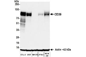 Western Blotting (WB) image for anti-Ectonucleoside Triphosphate diphosphohydrolase 1 (ENTPD1) (AA 300-350) antibody (ABIN7795686)