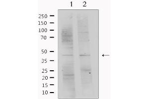 Western Blotting (WB) image for anti-serpin Peptidase Inhibitor, Clade F (Alpha-2 Antiplasmin, Pigment Epithelium Derived Factor), Member 1 (SERPINF1) (C-Term) antibody (ABIN6265012)