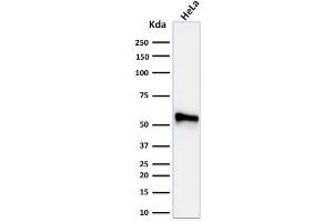 Western Blot Analysis of human HeLa cell lysate using Cytokeratin 7 Mouse Monoclonal Antibody (KRT7/760 + OV-TL12/30) (Cytokeratin 7 Antikörper)