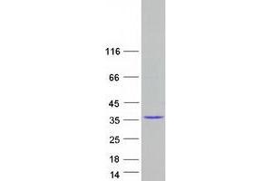 Western Blotting (WB) image for Ring Finger Protein 135 (RNF135) (Transcript Variant 3) protein (Myc-DYKDDDDK Tag) (ABIN2731019)