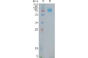 Human CD22(417-678) Protein, mFc Tag on SDS-PAGE under reducing condition.