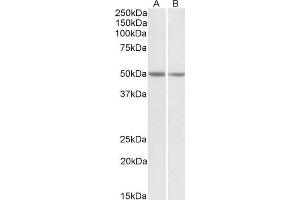 ABIN571171 (0. (GNAS Antikörper  (Internal Region))