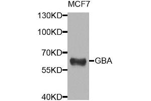 Western blot analysis of extracts of MCF-7 cells, using GBA antibody. (GBA Antikörper  (AA 40-250))