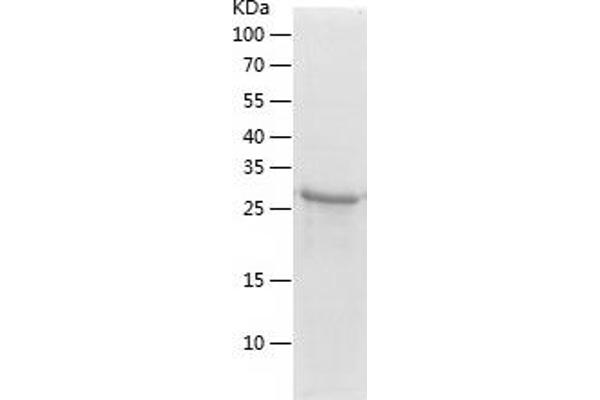 POLR2C Protein (AA 1-275) (His tag)