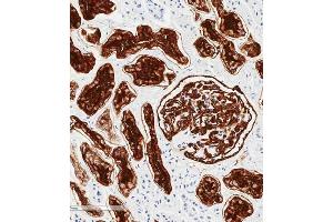 Immunohistochemical analysis of paraffin-embedded human kidney tissue using (ABIN6243087 and ABIN6577253) performed on the Leica® BOND RXm. (MME Antikörper  (AA 472-505))