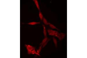 ABIN6274750 staining Hela cells by IF/ICC. (RPS18 Antikörper)