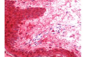 Anti-LGALS7 / Galectin 7 antibody IHC staining of human skin. (LGALS7 Antikörper  (HRP))