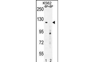 Western blot analysis of DEPD5 Antibody Pab pre-incubated without(lane 1) and with(lane 2) blocking peptide in K562 cell line lysate. (DEPDC5 Antikörper  (C-Term))