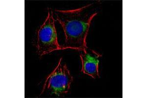 Immunofluorescence analysis of EC cells (rat aortic endothelial cells) using NGFR monoclonal antibody, clone 2F1C2  (green). (NGFR Antikörper)