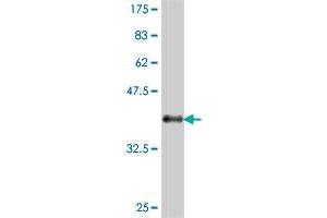 Western Blot detection against Immunogen (37. (CACNA1F Antikörper  (AA 1878-1977))