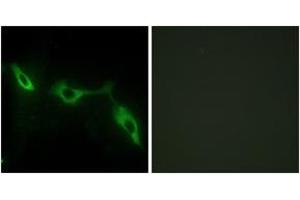 Immunofluorescence analysis of NIH-3T3 cells, using LEG9 Antibody. (Galectin 9 Antikörper  (AA 51-100))