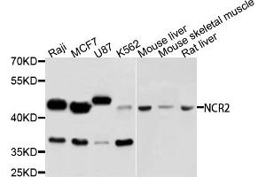 Western blot analysis of extracts of various cell lines, using NCR2 antibody (ABIN5995548) at 1/1000 dilution. (NKp44/NCR2 Antikörper)