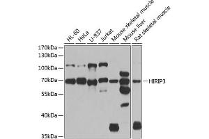 Western blot analysis of extracts of various cell lines, using HIRIP3 antibody (ABIN6128019, ABIN6141779, ABIN6141780 and ABIN6222788) at 1:1000 dilution. (HIRIP3 Antikörper  (AA 417-556))