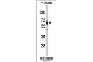 Western blot analysis of PHGDH Antibody in mouse brain tissue lysates (35ug/lane) (PHGDH Antikörper  (N-Term))