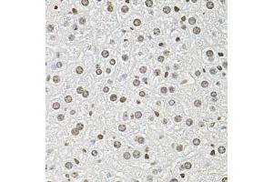 Immunohistochemistry of paraffin-embedded mouse liver using FOSL1 antibody. (FOSL1 Antikörper)