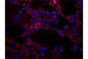 Immunofluorescence (IF) image for anti-Intercellular Adhesion Molecule 1 (ICAM1) antibody (ABIN2664765) (ICAM1 Antikörper)