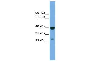SOCS1 antibody used at 1 ug/ml to detect target protein.