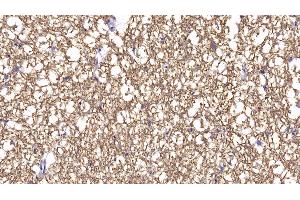 Immunohistochemistry (IHC) image for anti-Brain-Derived Neurotrophic Factor (BDNF) (AA 20-252) antibody (ABIN7427021)