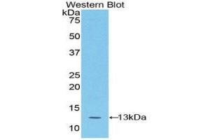 Western Blotting (WB) image for anti-S100 Calcium Binding Protein A4 (S100A4) (AA 1-101) antibody (ABIN1078504) (s100a4 Antikörper  (AA 1-101))
