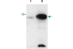 AIRE polyclonal antibody  staining (0. (AIRE Antikörper)