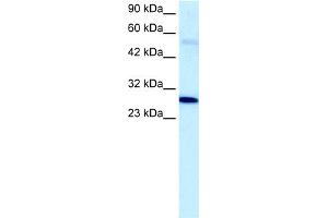 WB Suggested Anti-PAntibody Titration:  5. (PARP1 Antikörper  (C-Term))