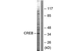 Western blot analysis of extracts from HeLa cells, treated with PMA 125ng/ml 30', using CREB (Ab-142) Antibody. (CREB1 Antikörper  (AA 111-160))