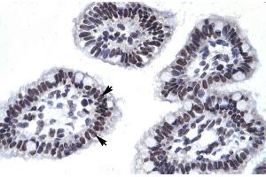 Human Intestine (AATF Antikörper  (N-Term))