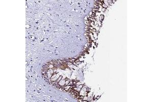 Immunohistochemical staining of human nasopharynx with UGT2A2 polyclonal antibody ( Cat # PAB28013 ) shows moderate cytoplasmic positivity in respiratory epithelial cells at 1:20 - 1:50 dilution.