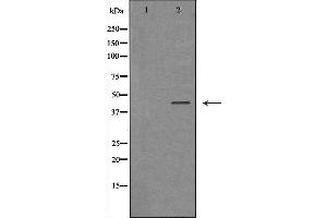 Western blot analysis of extracts of Jurkat, using IL2RG antibody. (IL2RG Antikörper  (N-Term))