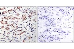 Immunohistochemistry (IHC) image for anti-STAT5 A/B (STAT5 A/B) (pTyr694) antibody (ABIN2888534) (STAT5 A/B Antikörper  (pTyr694))