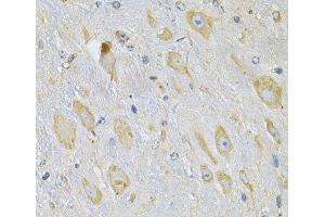 Immunohistochemistry (Paraffin-embedded Sections) (IHC (p)) image for anti-Thioredoxin Domain Containing 5 (Endoplasmic Reticulum) (TXNDC5) antibody (ABIN7008633)