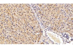 Detection of NEU in Porcine Liver Tissue using Polyclonal Antibody to Neuraminidase (NEU)