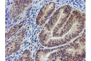 Immunohistochemistry (IHC) image for anti-Myeloid Leukemia Factor 2 (MLF2) antibody (ABIN1499502) (MLF2 Antikörper)