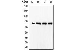 Western blot analysis of SRF expression in Jurkat (A), MCF7 (B), HeLa (C), Raw264. (SRF Antikörper  (Center))
