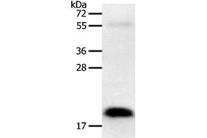 Western Blot analysis of Human colon cancer tissue using PTN Polyclonal Antibody at dilution of 1:600