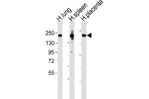 All lanes : Anti-MRC1L1 Antibody (N-term) at 1:2000 dilution Lane 1: human lung lysates Lane 2: human spleen lysates Lane 3: human placenta lysates Lysates/proteins at 20 μg per lane.