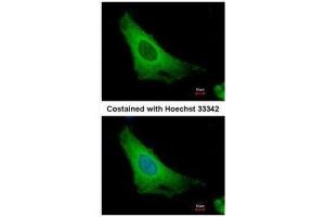 Immunofluorescence (IF) image for anti-ADP-Ribosylation Factor 3 (ARF3) antibody (ABIN2855949)