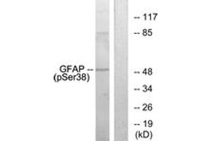 Western blot analysis of extracts from HeLa cells, using GFAP (Phospho-Ser38) Antibody. (GFAP Antikörper  (pSer38))