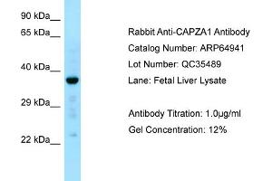 Western Blotting (WB) image for anti-Capping Protein (Actin Filament) Muscle Z-Line, alpha 1 (CAPZA1) (N-Term) antibody (ABIN2790000)