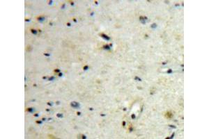 Used in DAB staining on fromalin fixed paraffin-embedded Brain tissue