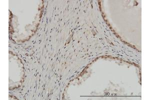 Immunoperoxidase of monoclonal antibody to ZNF202 on formalin-fixed paraffin-embedded human prostate. (ZNF202 Antikörper  (AA 301-400))
