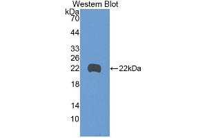 Western Blotting (WB) image for anti-Growth Arrest and DNA-Damage-Inducible, beta (GADD45B) (AA 1-160) antibody (ABIN2116595) (GADD45B Antikörper  (AA 1-160))