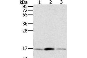 Western Blot analysis of Hela, hepg2 and PC3 cell using PPIA Polyclonal Antibody at dilution of 1:300 (PPIA Antikörper)